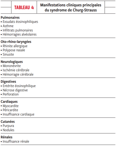 Manifestations cliniques principales du syndrome de Churg & Strauss Manifestations cliniques principales du syndrome de Churg & Strauss