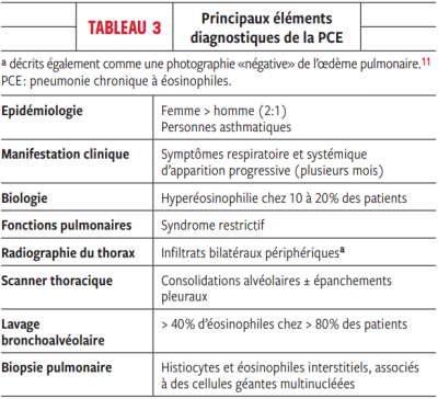 Principaux éléments diagnostiques de la PCE Principaux éléments diagnostiques de la PCE