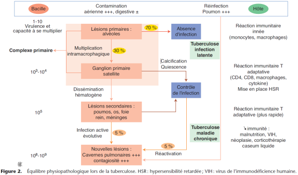 Équilibre physiopathologique lors de la tuberculose Équilibre physiopathologique lors de la tuberculose